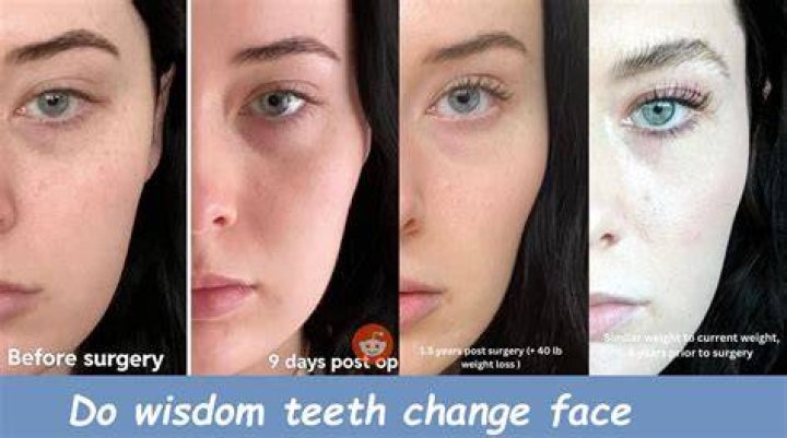 Cynthia Nixon’s Teeth: Before And After!