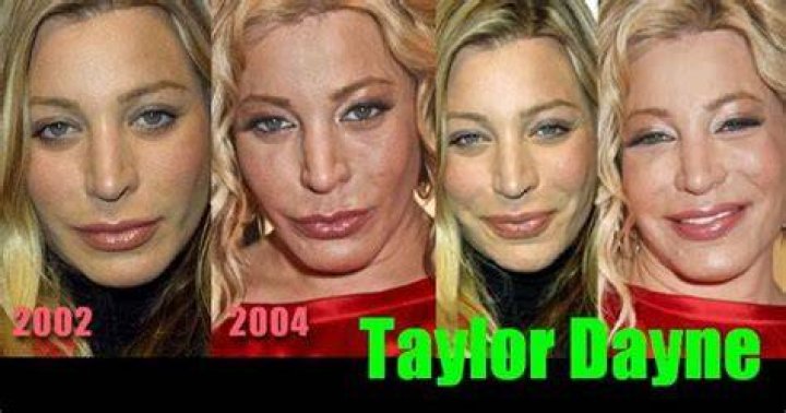 Taylor Dayne Regrets Plastic Surgery; She Wishes She Had Never Done It!