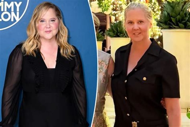 Where Did Amy Schumer Grow Up?